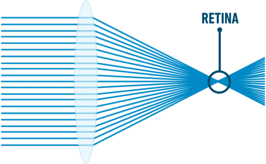 without-residual